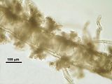 2 – Cellula assiali subquadrate nella porzione prossimale del tallo